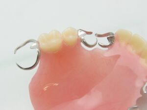入れ歯　保険治療